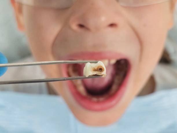 Best Urgent Tooth Repair  in Pataskala, OH